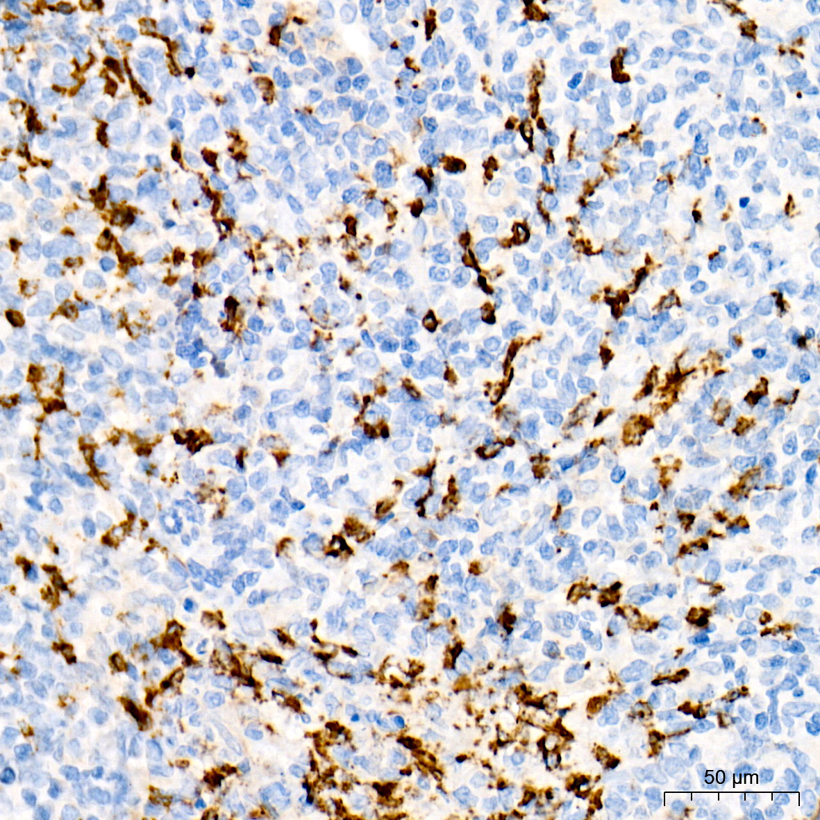 Myeloperoxidase (MPO) Rabbit Monoclonal Antibody - Image 2