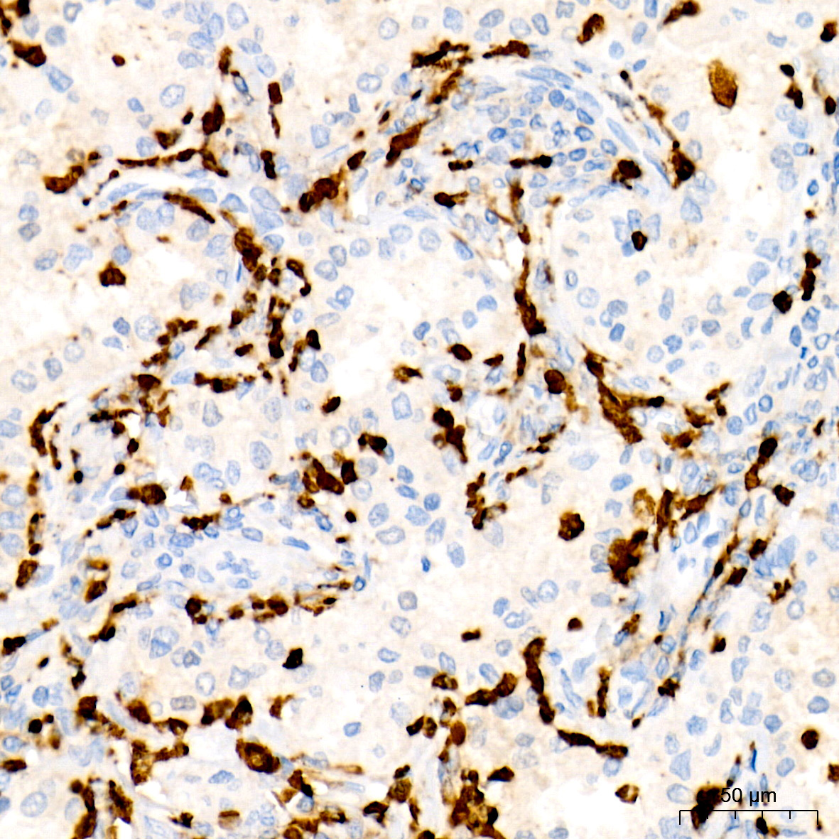 Myeloperoxidase (MPO) Rabbit Monoclonal Antibody - Image 3