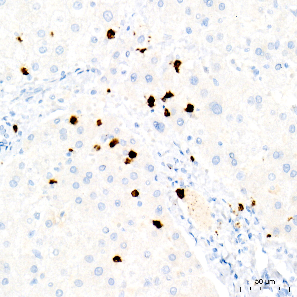 Myeloperoxidase (MPO) Rabbit Monoclonal Antibody - Image 4