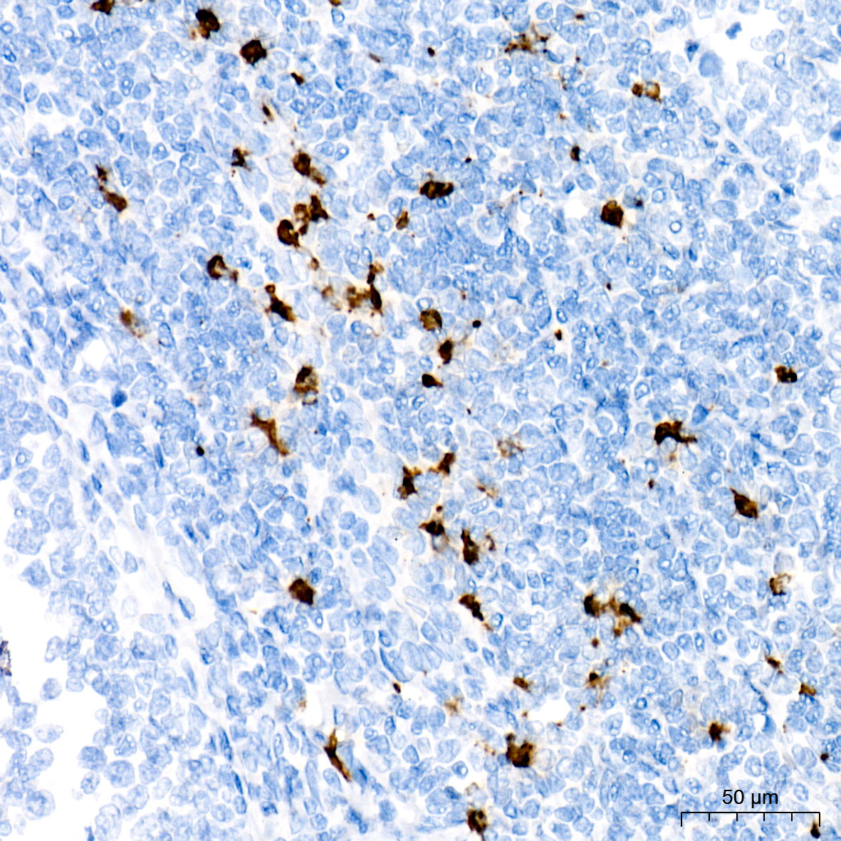 Myeloperoxidase (MPO) Rabbit Monoclonal Antibody - Image 5