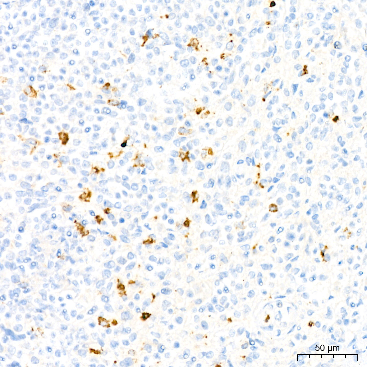 Myeloperoxidase (MPO) Rabbit Monoclonal Antibody