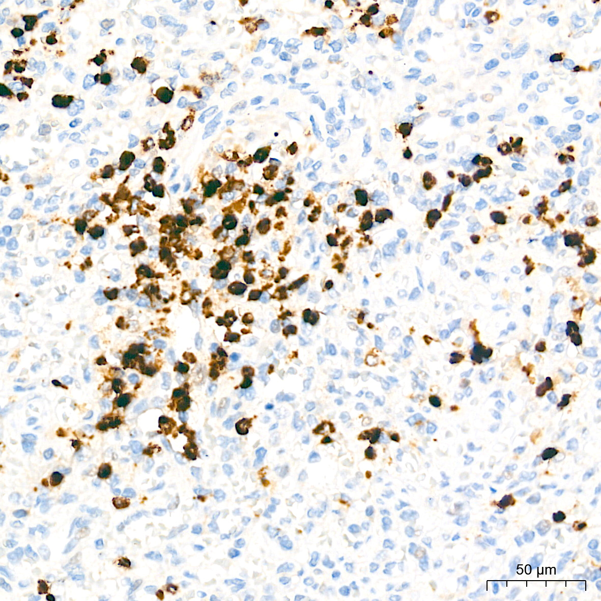 Myeloperoxidase (MPO) Rabbit Polyclonal Antibody
