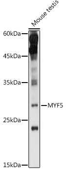 MYF5 Rabbit Polyclonal Antibody