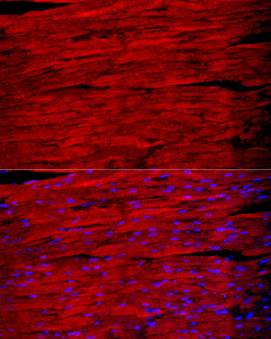 MYH1 Rabbit Polyclonal Antibody - Image 5