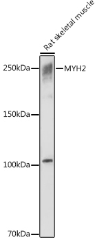 MYH2 Rabbit Polyclonal Antibody