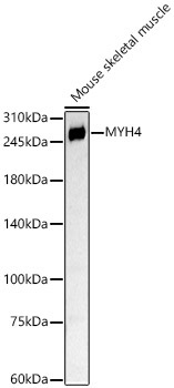 MYH4 Rabbit Polyclonal Antibody
