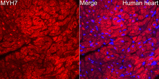 MYH7 Rabbit Polyclonal Antibody - Image 3