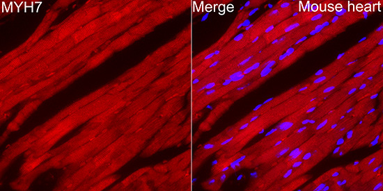 MYH7 Rabbit Polyclonal Antibody - Image 4