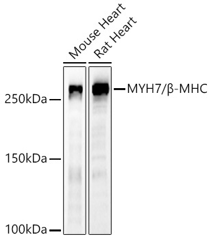 MYH7/Beta-MHC Rabbit Polyclonal Antibody