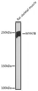 MYH7B Rabbit Monoclonal Antibody - Image 2