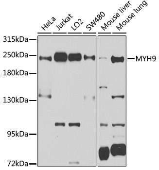 MYH9 Rabbit Polyclonal Antibody