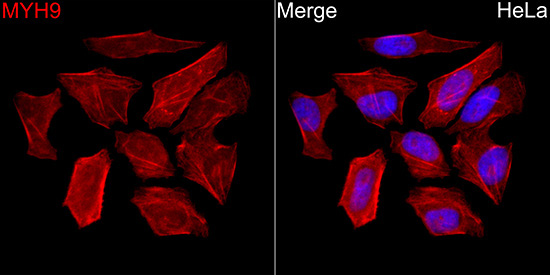 MYH9 Rabbit Polyclonal Antibody