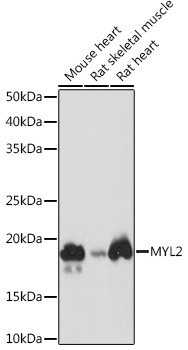 MYL2 Rabbit Monoclonal Antibody