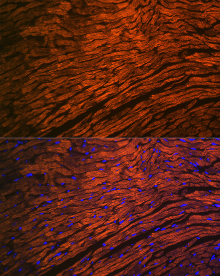 MYL2 Rabbit Monoclonal Antibody - Image 3