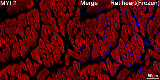 MYL2 Rabbit Monoclonal Antibody - Image 5