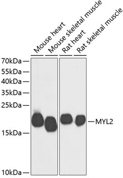 MYL2 Rabbit Polyclonal Antibody