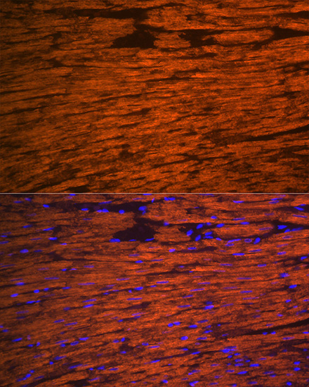 MYL2 Rabbit Polyclonal Antibody - Image 2
