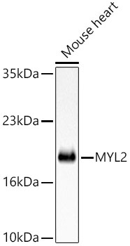 MYL2 Rabbit Polyclonal Antibody