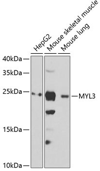 MYL3 Rabbit Polyclonal Antibody