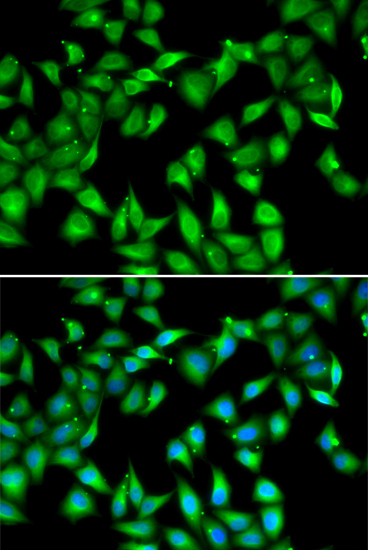 MYL3 Rabbit Polyclonal Antibody - Image 2