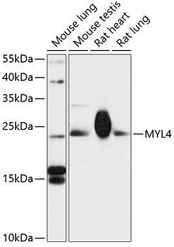MYL4 Rabbit Polyclonal Antibody