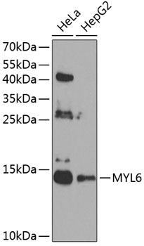 MYL6 Rabbit Polyclonal Antibody