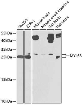 MYL6B Rabbit Polyclonal Antibody