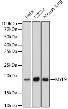 MYL9 Rabbit Monoclonal Antibody