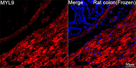 MYL9 Rabbit Monoclonal Antibody - Image 3