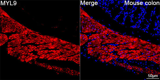 MYL9 Rabbit Monoclonal Antibody - Image 5