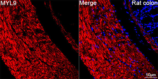 MYL9 Rabbit Monoclonal Antibody - Image 6