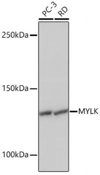 MYLK Rabbit Monoclonal Antibody