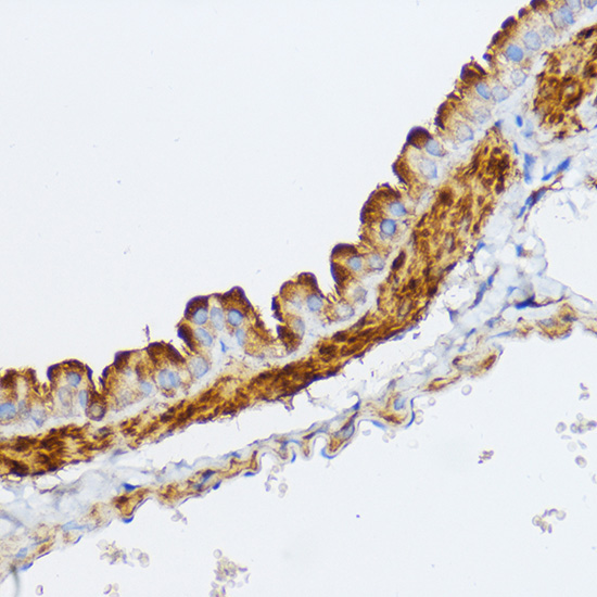 MYLK Rabbit Polyclonal Antibody