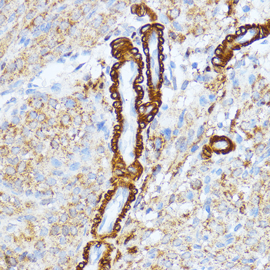 MYLK Rabbit Polyclonal Antibody - Image 2