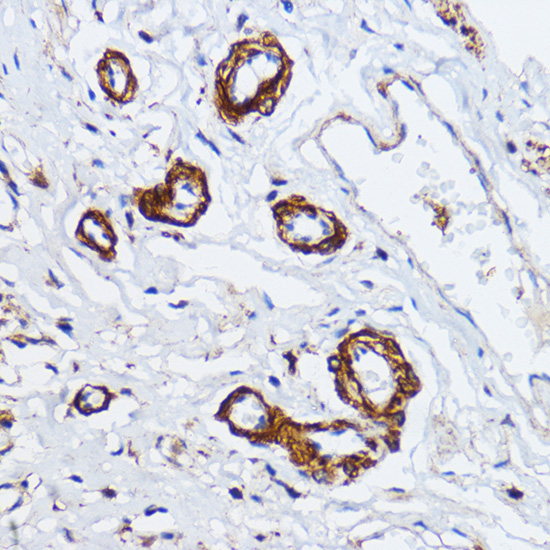 MYLK Rabbit Polyclonal Antibody - Image 3