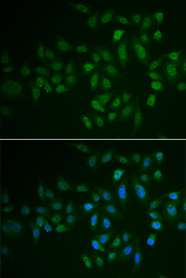 MYLK3 Rabbit Polyclonal Antibody