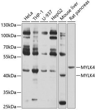 MYLK4 Rabbit Polyclonal Antibody