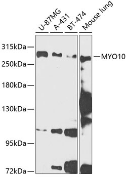 MYO10 Rabbit Polyclonal Antibody