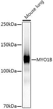 MYO1B Rabbit Monoclonal Antibody