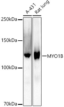 MYO1B Rabbit Monoclonal Antibody - Image 2