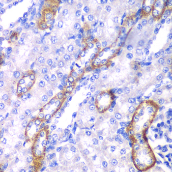 MYO1C Rabbit Polyclonal Antibody - Image 2