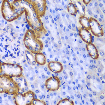 MYO1C Rabbit Polyclonal Antibody - Image 3