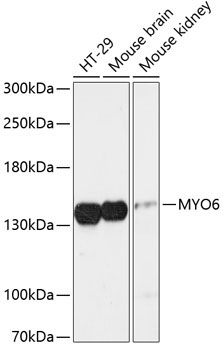 MYO6 Rabbit Polyclonal Antibody