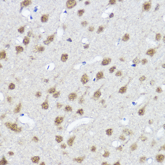 MYOCD Rabbit Polyclonal Antibody