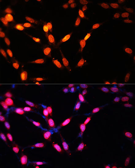 Myogenin Rabbit Polyclonal Antibody - Image 2