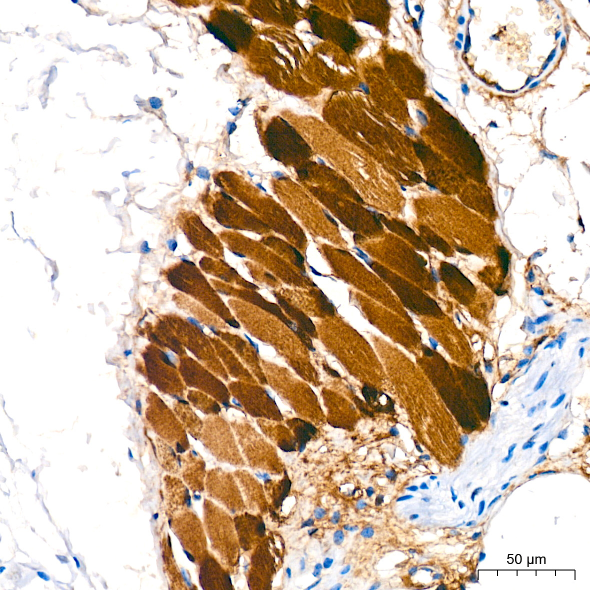 Myoglobin Rabbit Monoclonal Antibody - Image 2