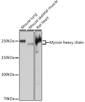 Myosin heavy chain Rabbit Monoclonal Antibody