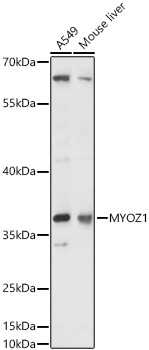 MYOZ1 Rabbit Polyclonal Antibody