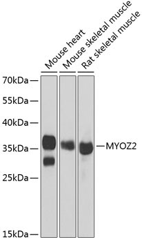 MYOZ2 Rabbit Polyclonal Antibody