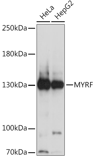 MYRF Rabbit Polyclonal Antibody
